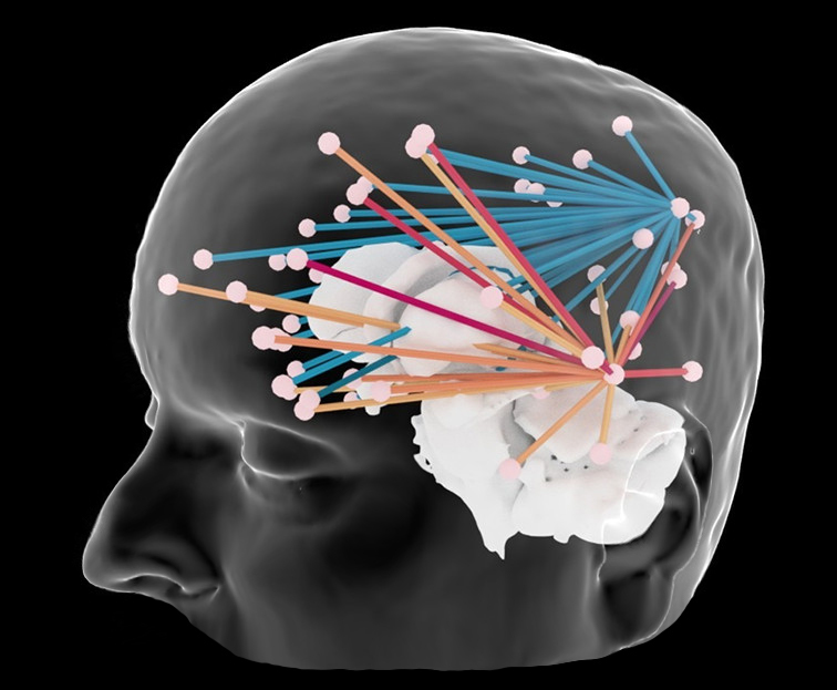 Brain connectivity with outer skin and subcorticals