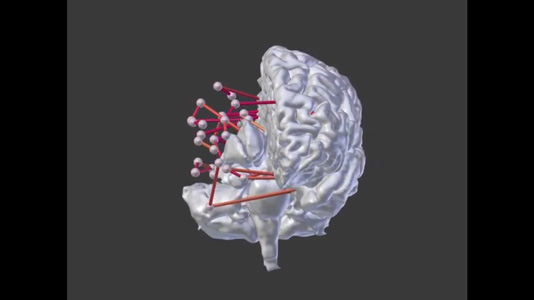 MMVT fMRI resting connectivity video thumbnail