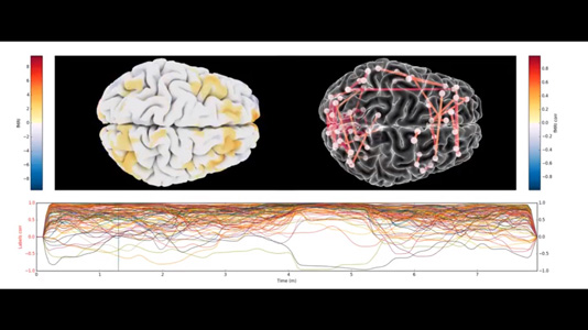 MMVT fMRI resting state connectivity and raw video thumbnail