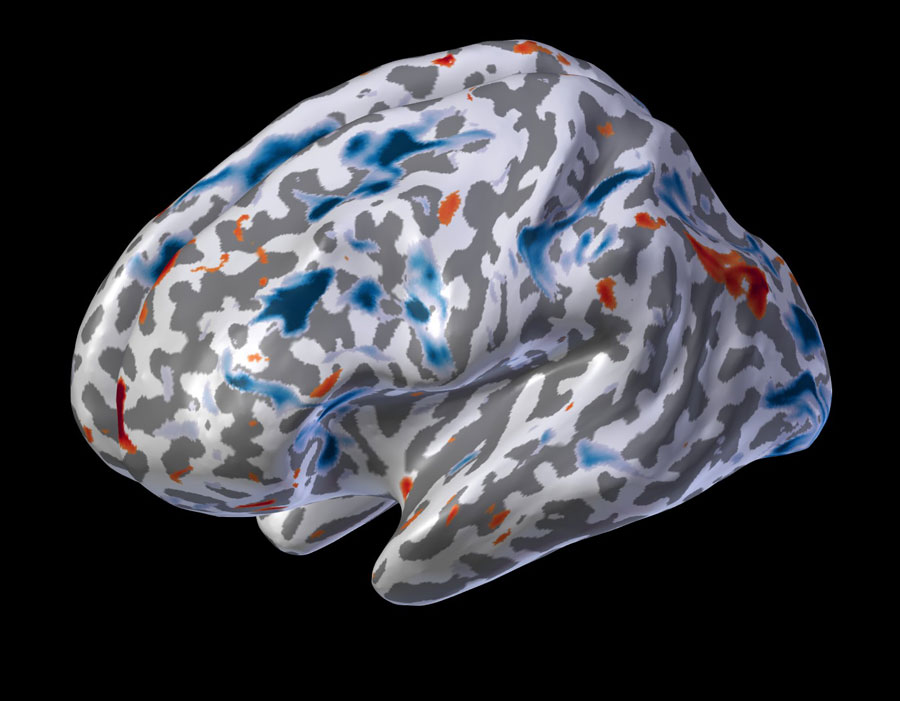 fMRI on 3D inflated brain.
